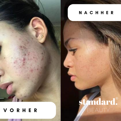 Bounce Back Serum – 1,5% Hyaluron + Peptid Complex